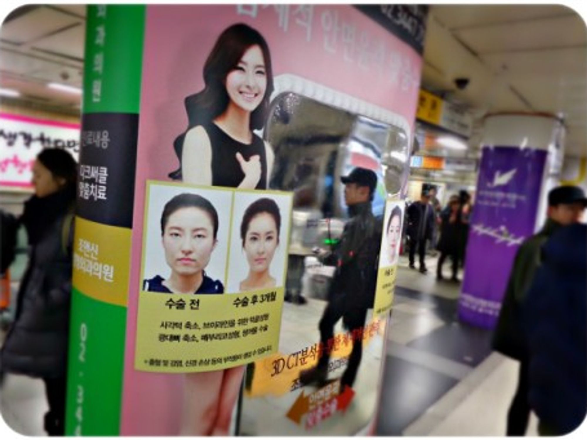 Plastic surgery ads in Seoul's Apgujeong subway station