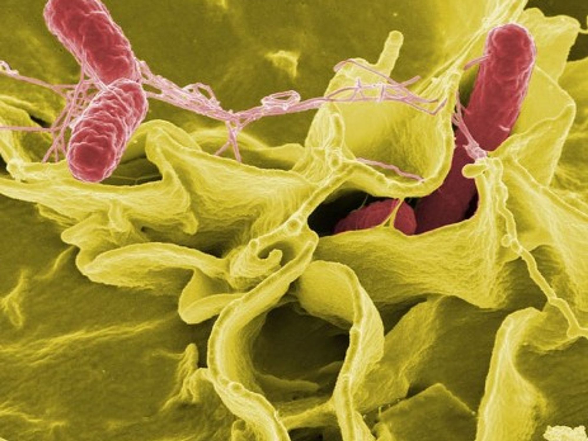 Salmonella infecting a human cell