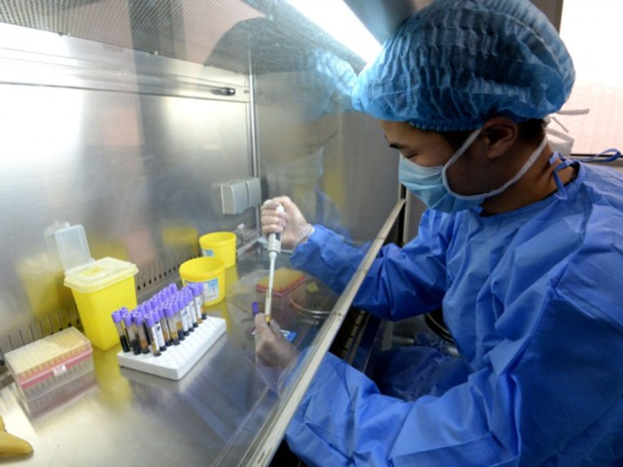 Scientist testing HIV antibodies in lab