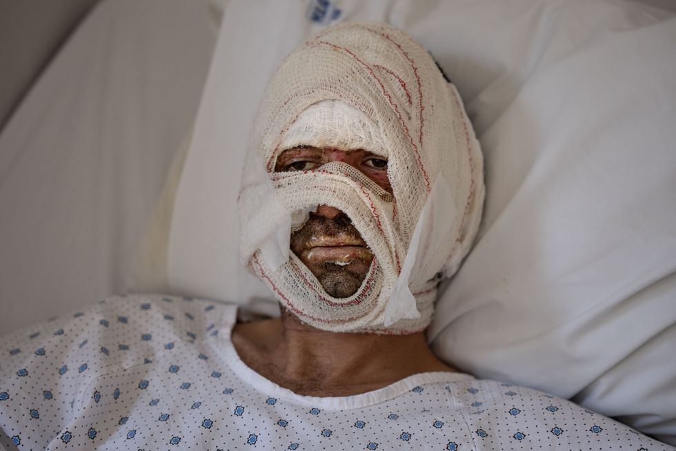 The 38-years-old Hassan seen laying on a bed in the burn unit, at Geitawi Hospital in Lebanon. During one of the bombings in Dahiye his car was engulfed in flames and he suffered severe burns.