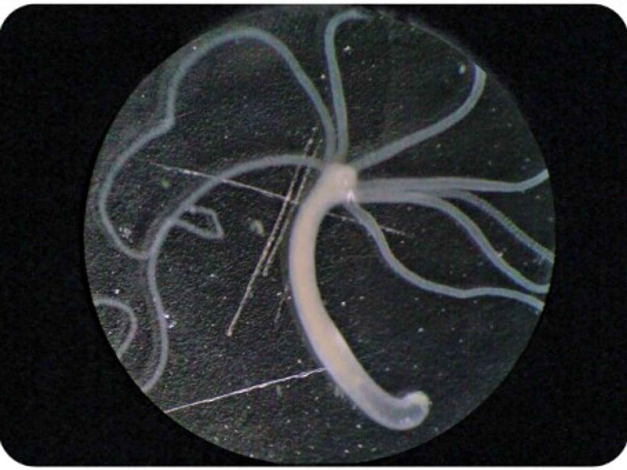 The "immortal" hydra
