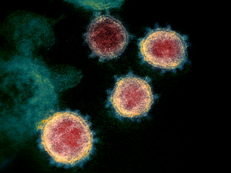 The Novel Coronavirus SARS-CoV-2