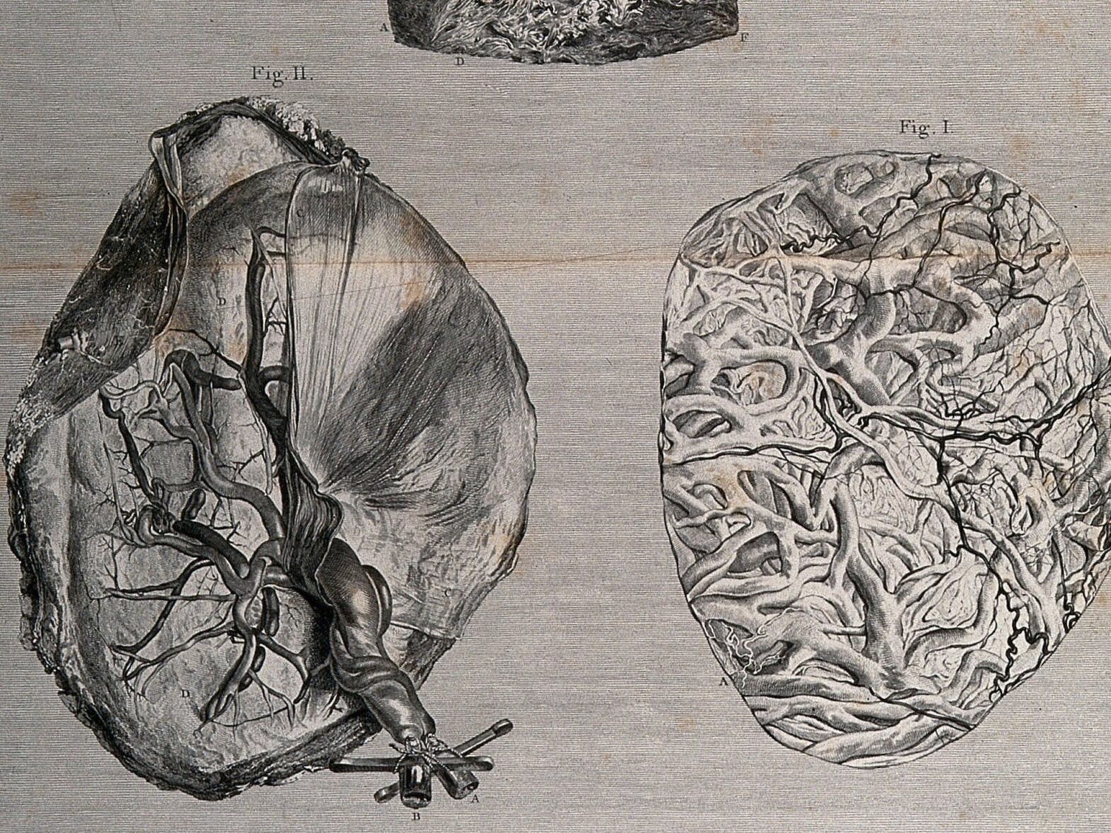 The outer forepart of the uterus, the inside of the placenta and a portion of the internal surface of the uterus.
