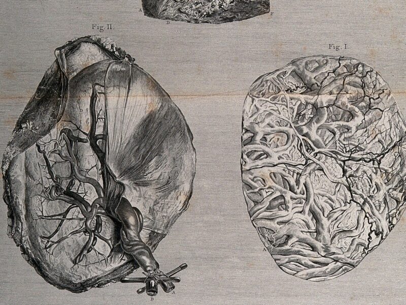 The outer forepart of the uterus, the inside of the placenta and a portion of the internal surface of the uterus.