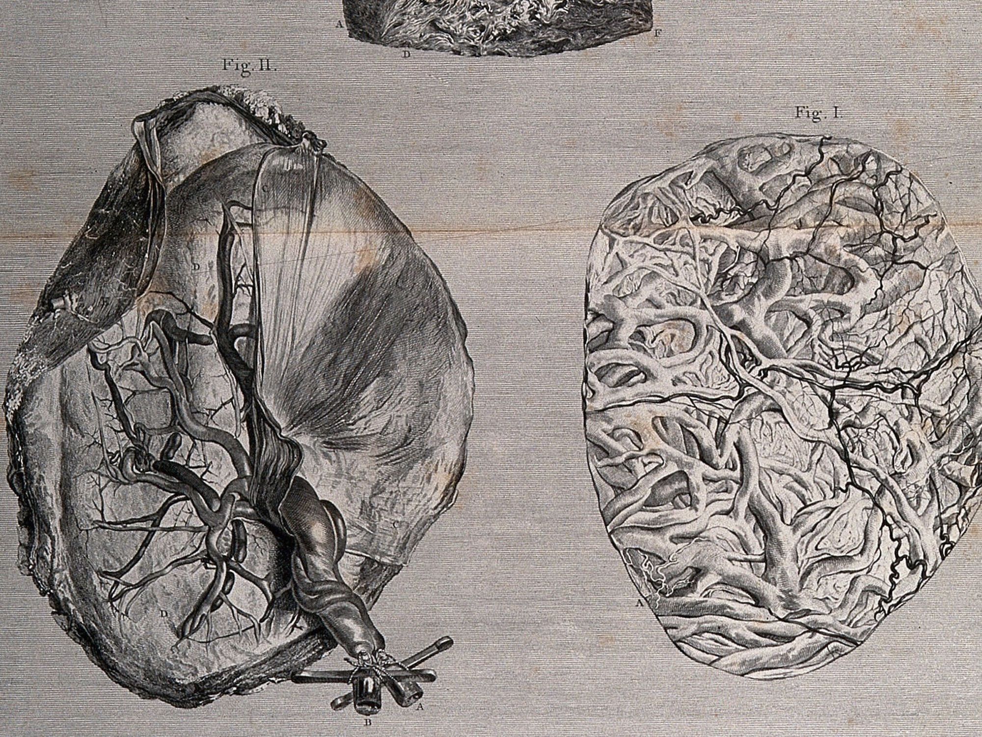 The outer forepart of the uterus, the inside of the placenta and a portion of the internal surface of the uterus.