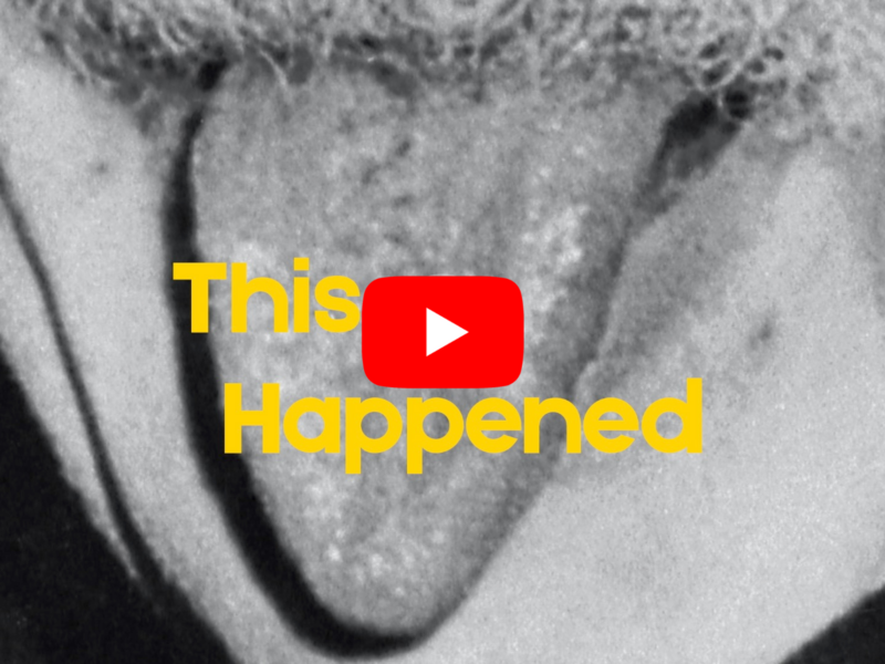 This Happened - March 14: That Wacky Photo Of Albert Einstein