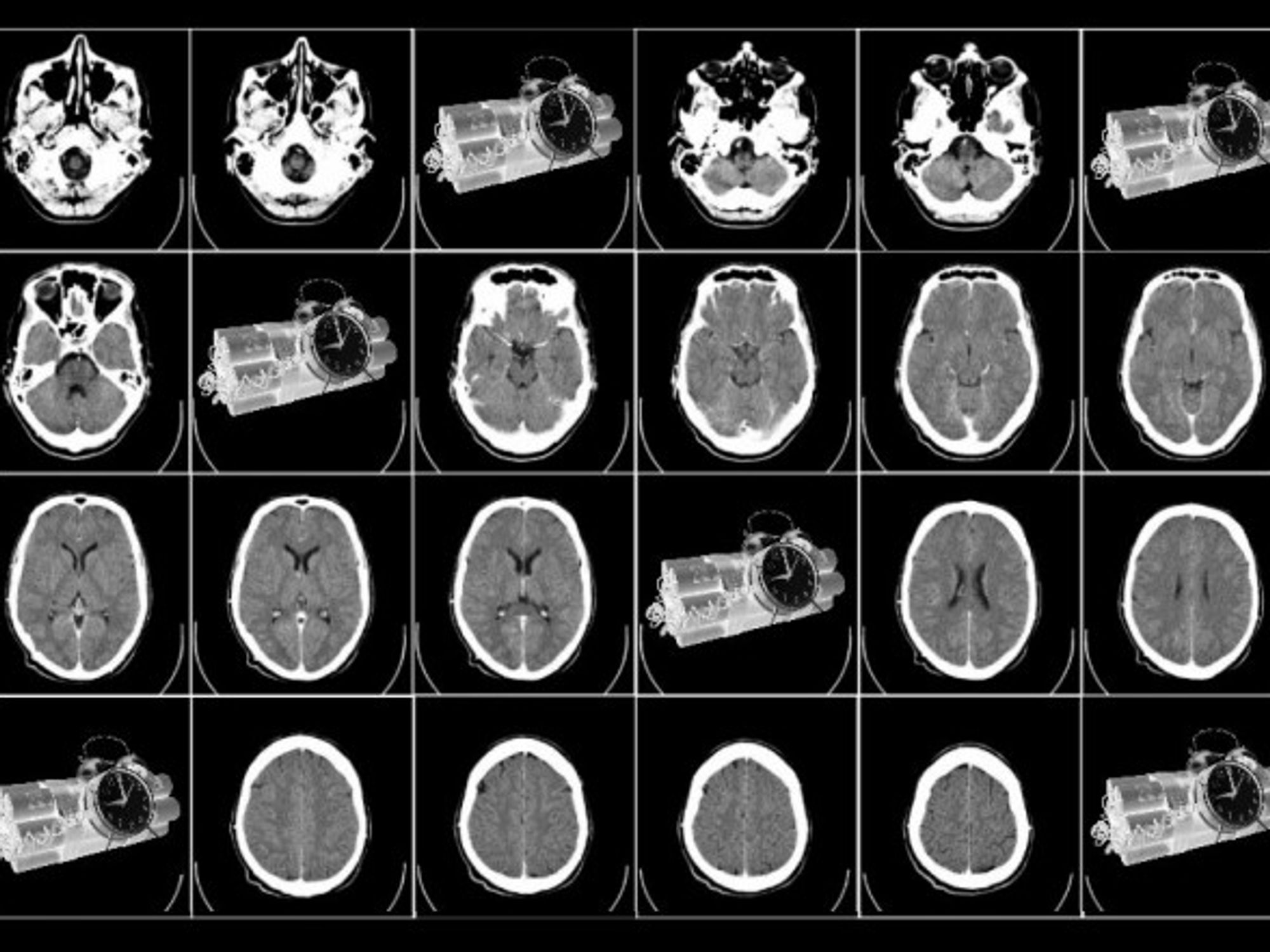 Vengeance, Guilt, Mysticism: The Making Of A Terrorist Mind