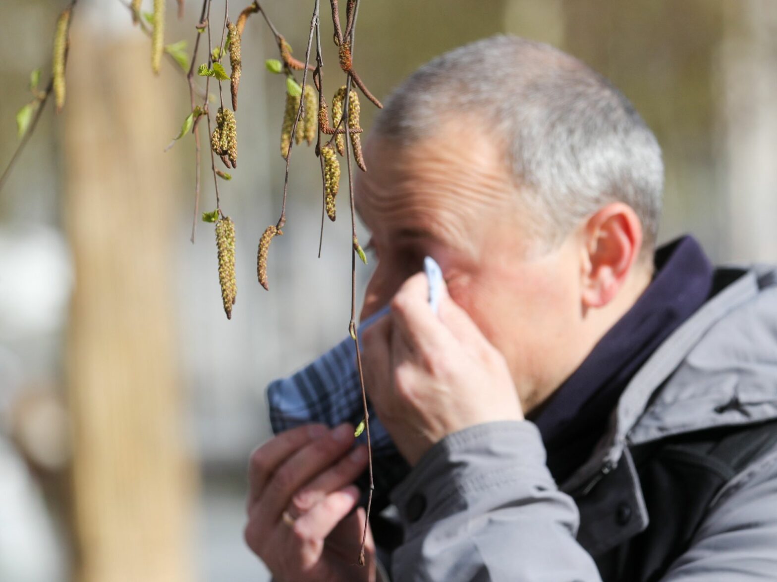 A man with signs of allergies in Moscow.