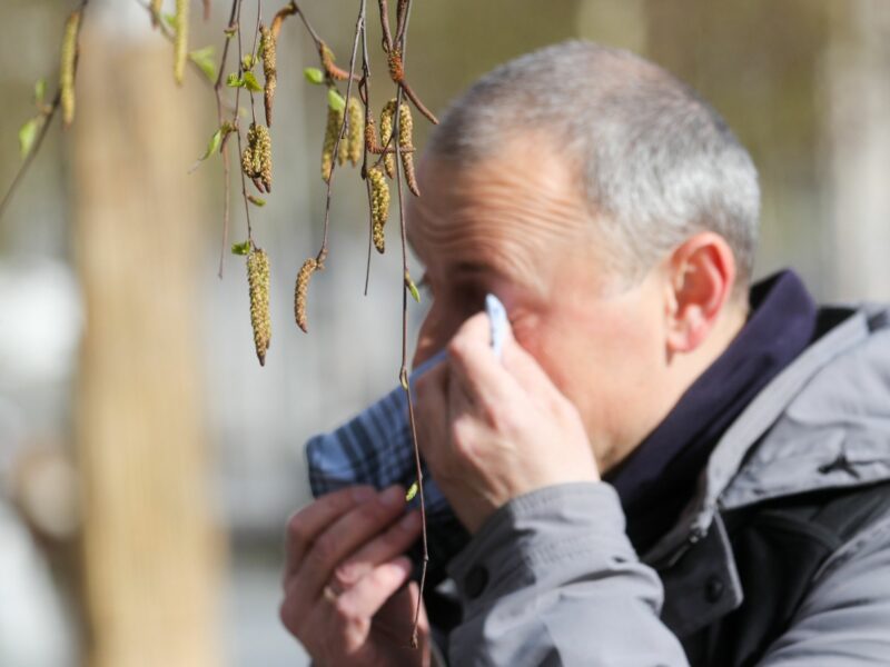 A man with signs of allergies in Moscow.
