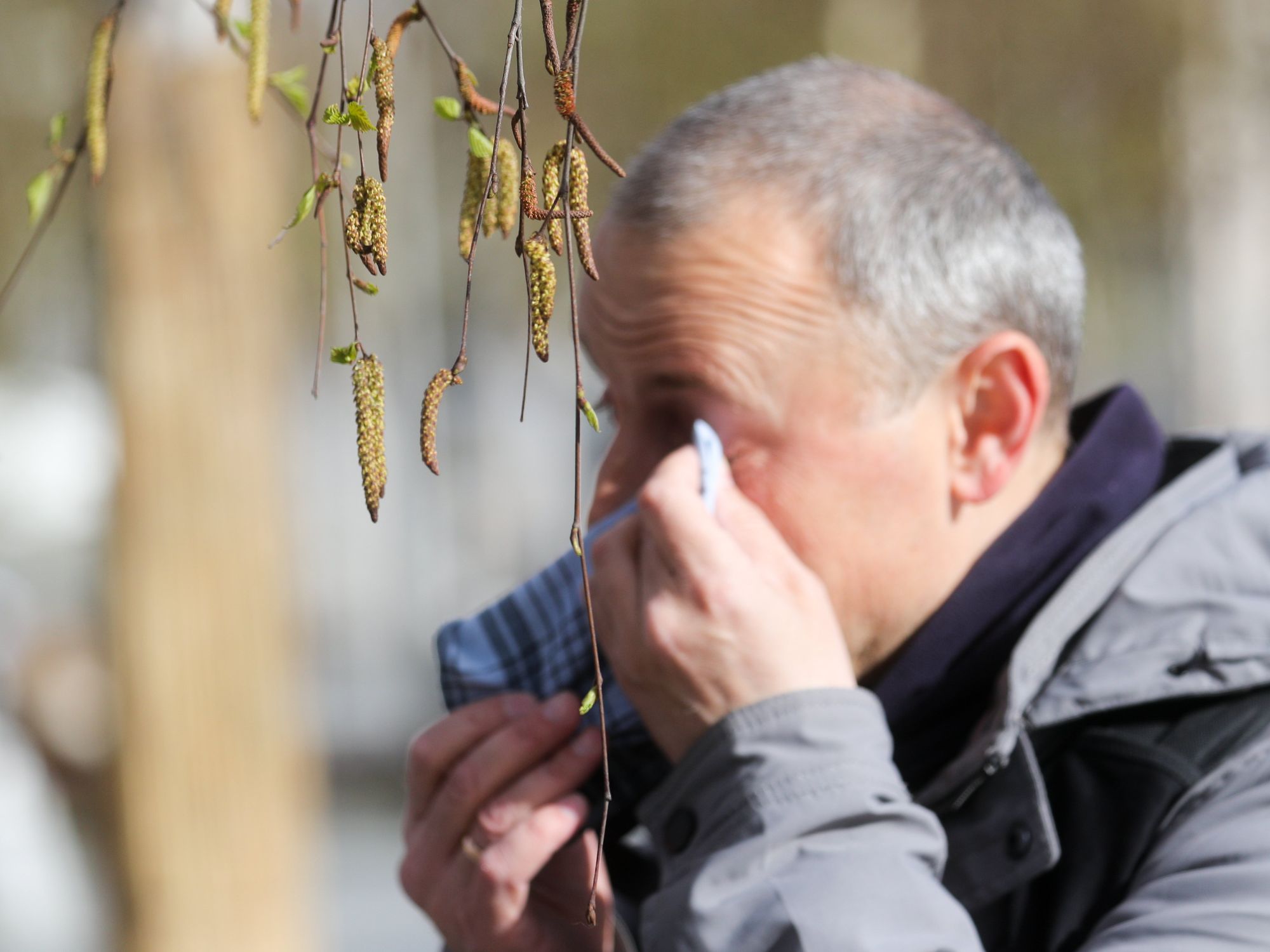 A man with signs of allergies in Moscow.